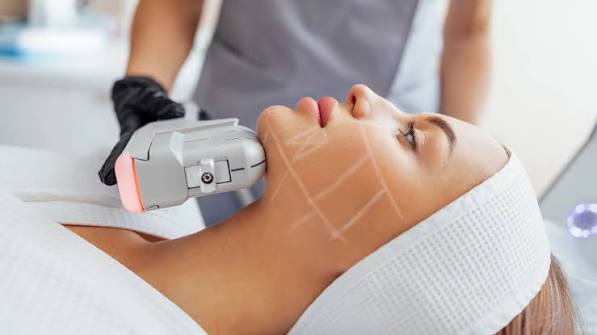 HIFU Skin Tightening