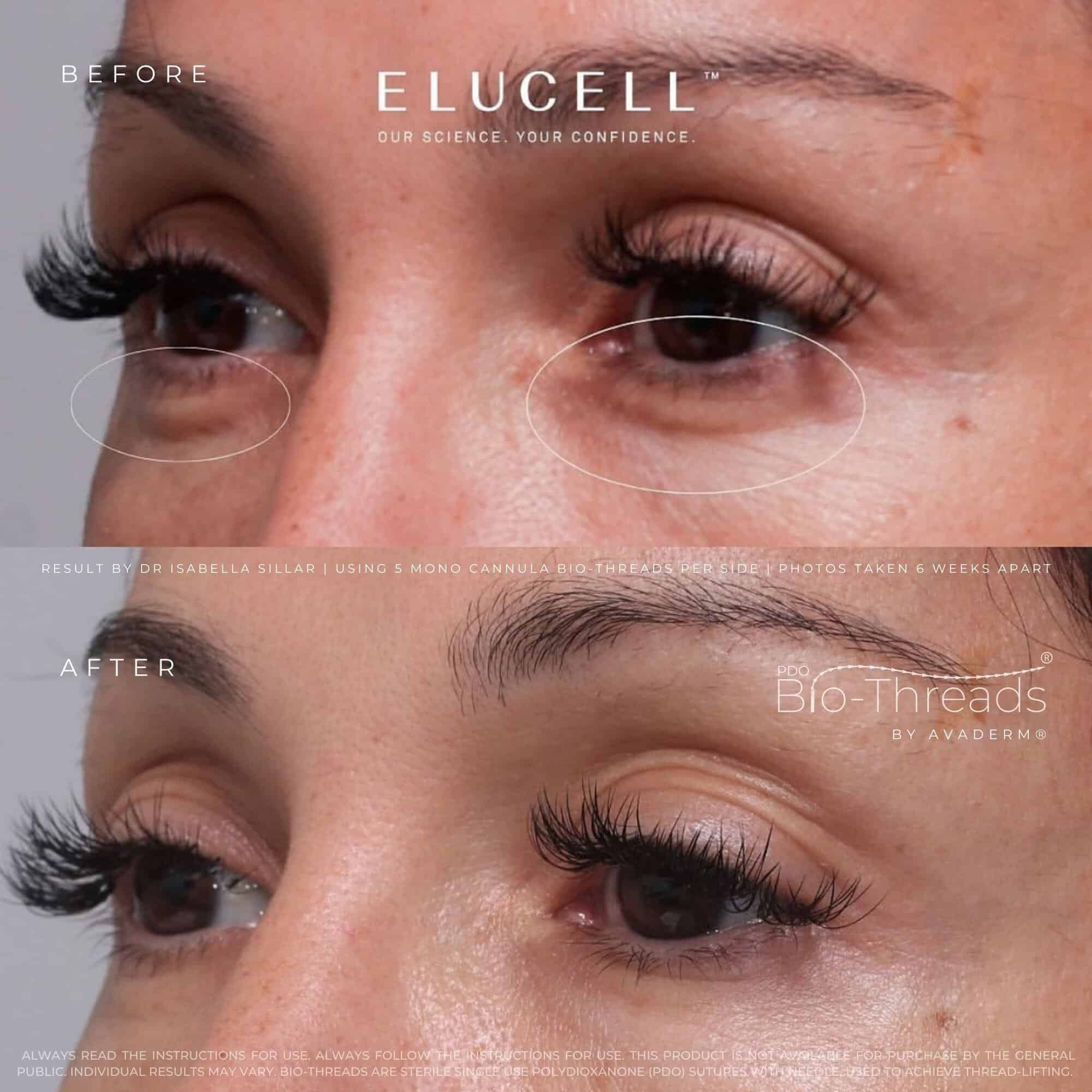 Eye treatment result reference